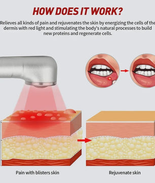 Rood Lichttherapie Apparaat voor Koortslip & Huidverzorging - 660nm/850nm LED