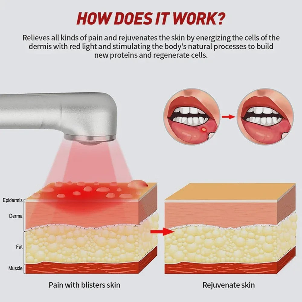 Rood Lichttherapie Apparaat voor Koortslip & Huidverzorging - 660nm/850nm LED
