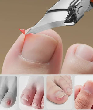 Roestvrijstalen Teennagelknipper met Schuine Rand voor Dikke, Kromme Nagels