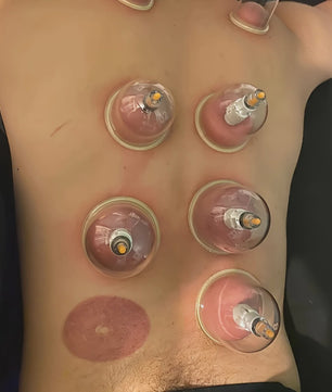 Professionele Cupping Set met 24 Cups, Pomp & Gids - Ontspanning & Massage