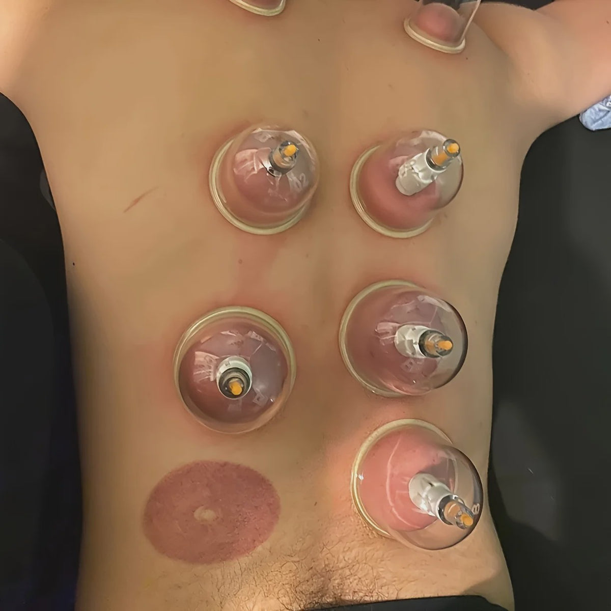 Professionele Cupping Set met 24 Cups, Pomp & Gids - Ontspanning & Massage