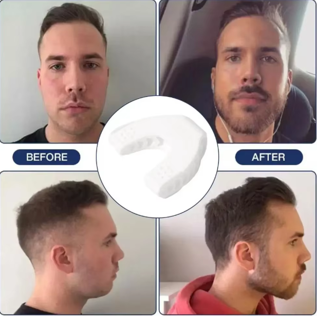 Kaaktrainer Set 3 Niveaus – Jaw Trainer voor Gezichts- en Nekspieren en Strakkere Kaaklijn