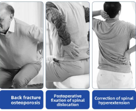 Thoracolumbale Rugbrace – Hyperextensie Houdingscorrector en Wervelkolom Ondersteuning